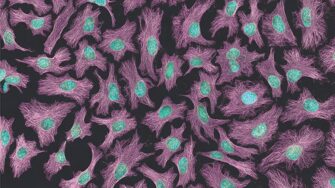 Henrietta Lacks’ Immortal Cells