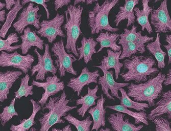 Henrietta Lacks’ Immortal Cells